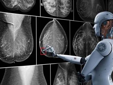 KI-Mammographie
